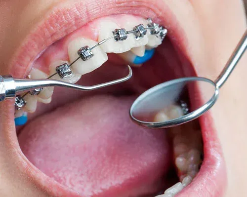 Orthodontics